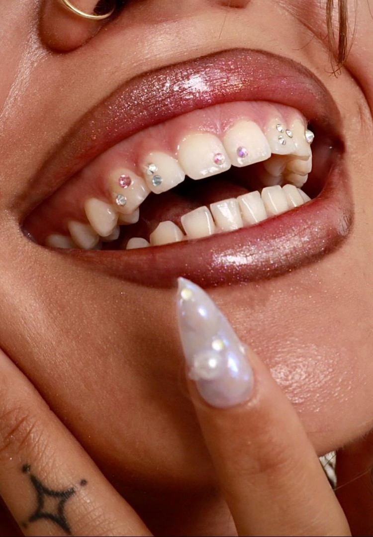 Close-up of tooth gems with crystal accents